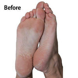 Emjoi Micro-Pedi Refill Rollers (Extra Coarse) - Pack of 4